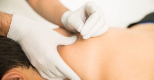 dry needling vs acupuncture